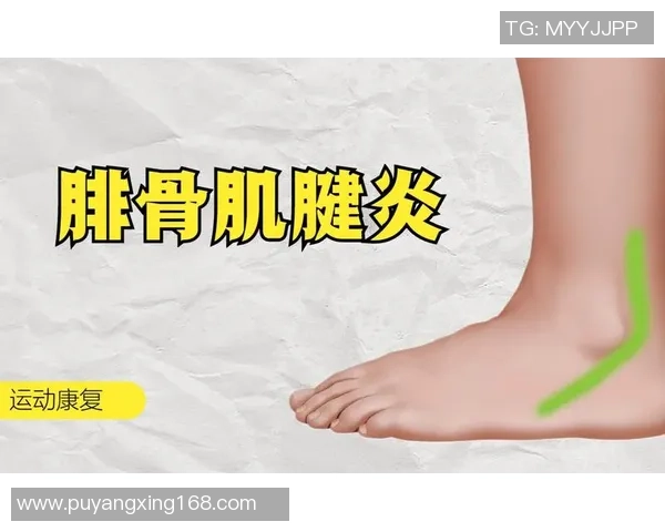 扁平足患者如何在打篮球时有效缓解脚踝疼痛的实用指南